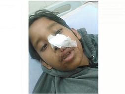 12 Years Old Ankit Needs Your Help Fight Grade 4 Brain Cancer