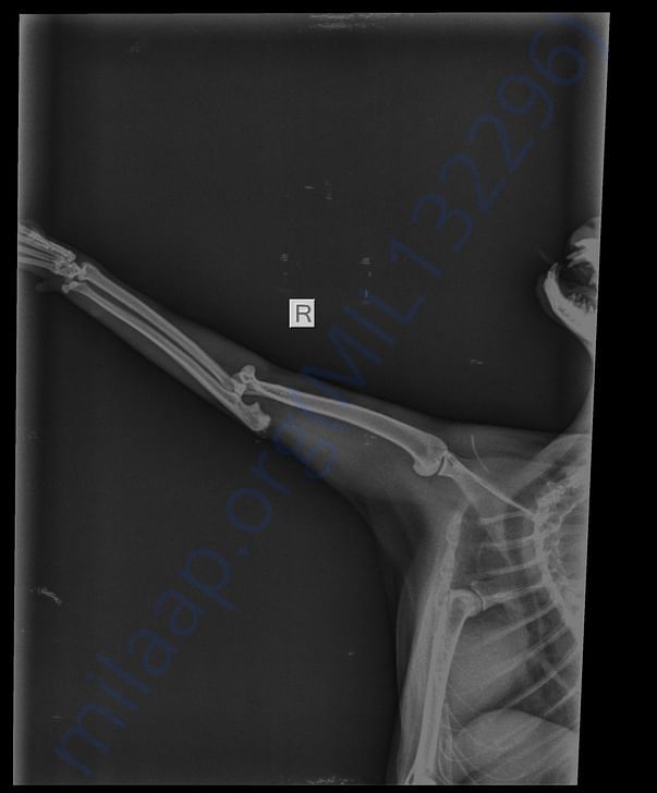X-ray right leg showing dislocated bone and paw