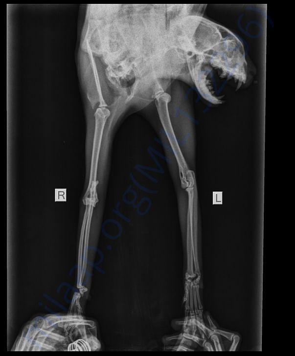 X-ray of both legs showing the damage