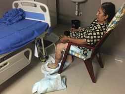 Support K Sathyavathi Recover From Gas Cylinder Blast Accident