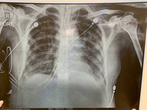 medical report