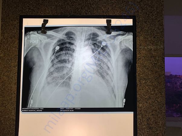 medical report