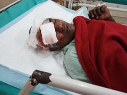 Support Hemanth Kumar Recover From Accident (Head Injury)
