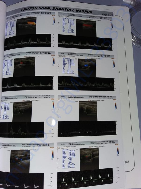 Scan report