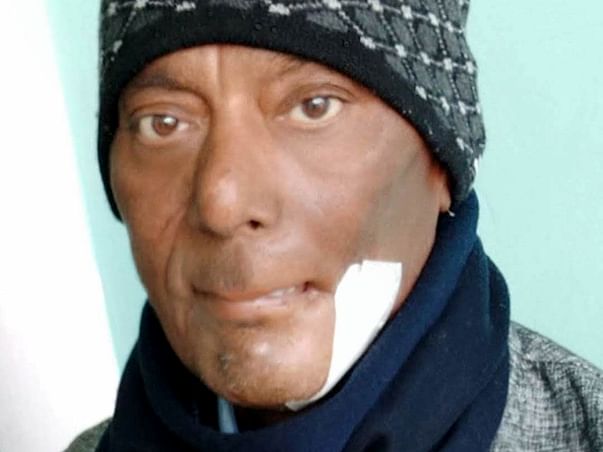 Help My Father Fight Cancer