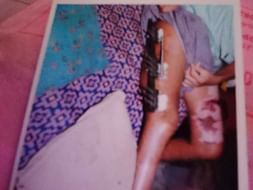 Support Viswanathan Recover From Leukemia And Accident(Leg Injury)