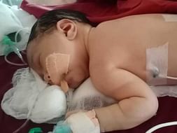 Help This 5 Days Old Fight Meconium Aspiration Syndrome