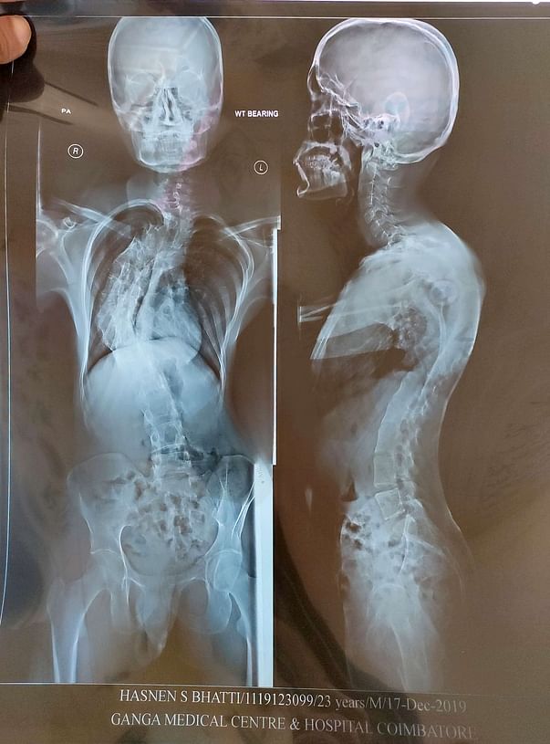 X-RAY