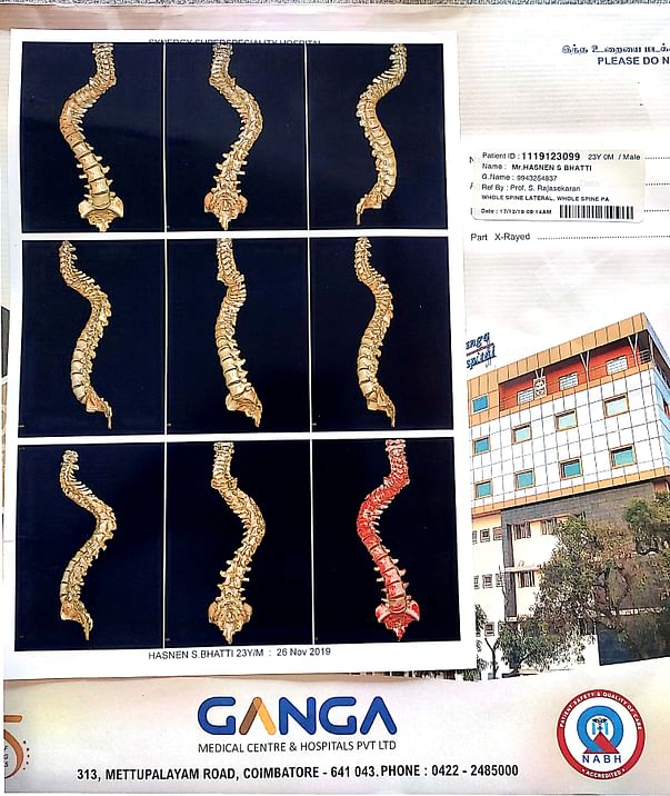 Spine Curvature Photo