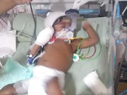 Baby Of Sowramya Needs Your Help To Recover From Atrial Septal Defects