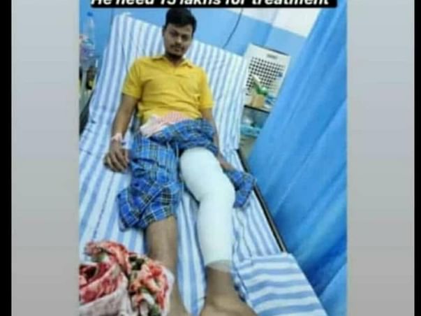 Help Nagesh Recover