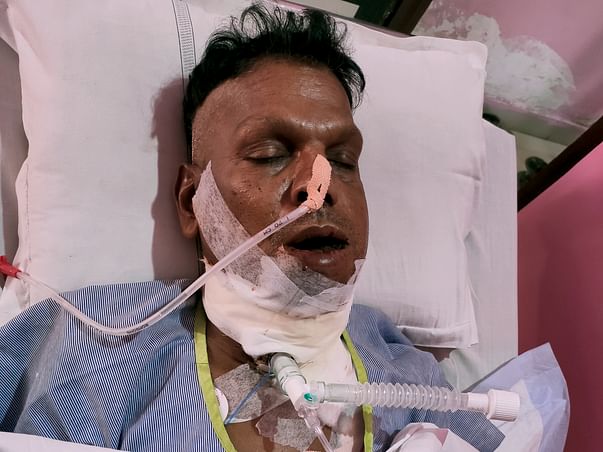 Help My Father Fight Oral Cancer