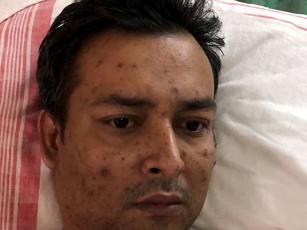 Help & Support Manash Boruah Recover From Coma