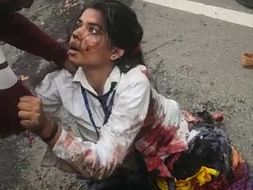 Help 19 Year Old Shalini Recover From Accident & Amputation