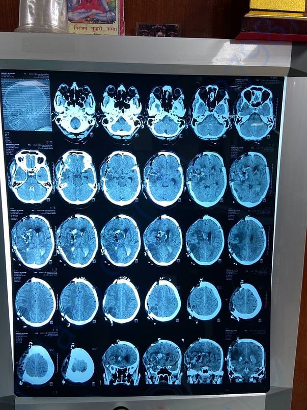 CT SCAN