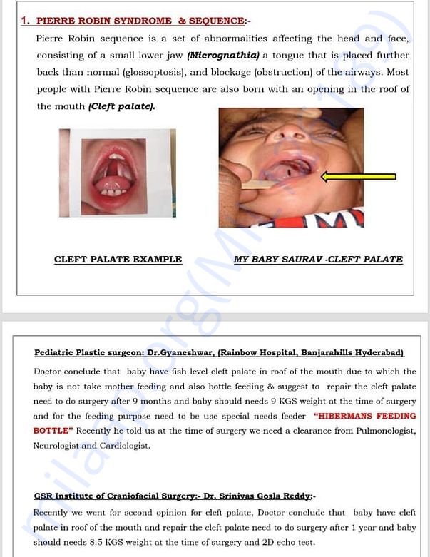 1) MY BABY WITH PERRIE ROBIN SYNDROME HAVING CLEFT PALATE