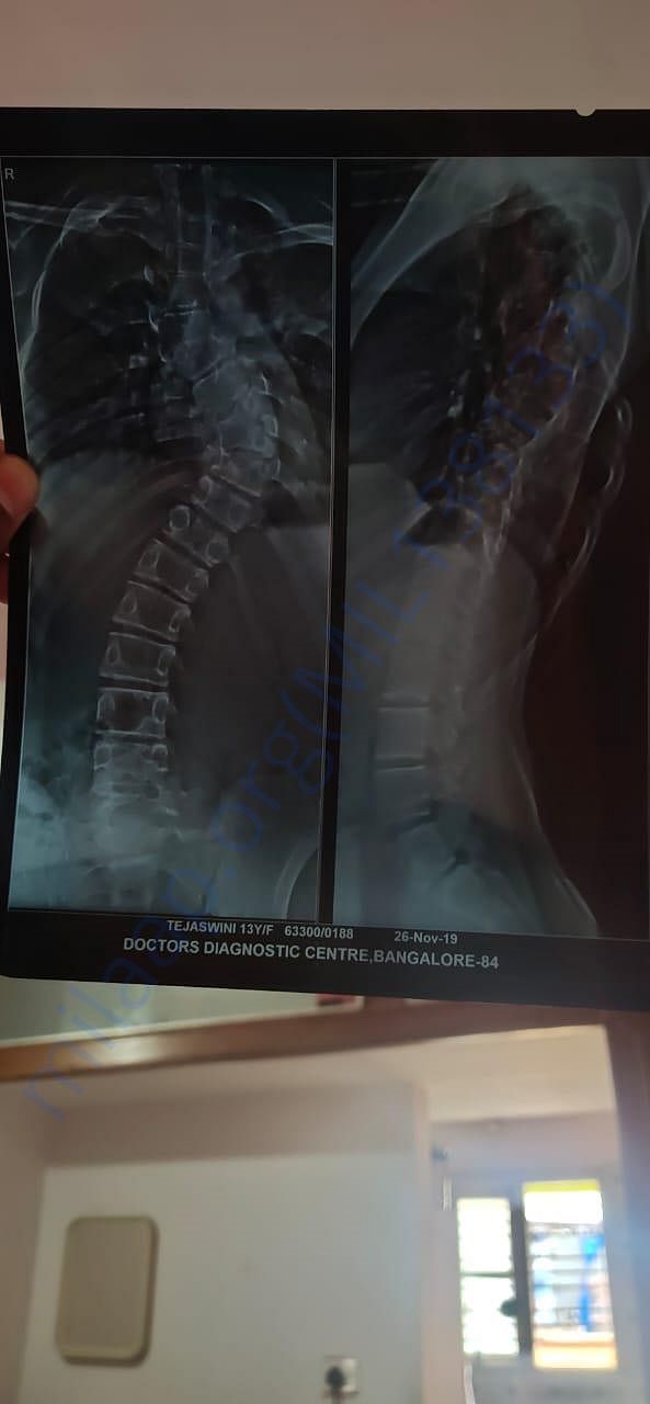 X-RAY Report