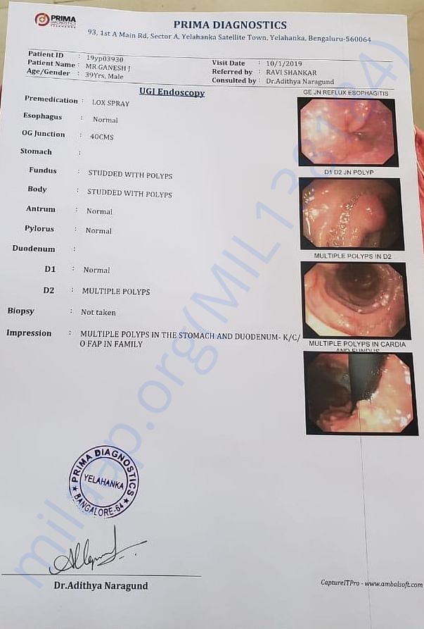 Colonoscopy and Endoscopy Report_Ganesh Janakiraman