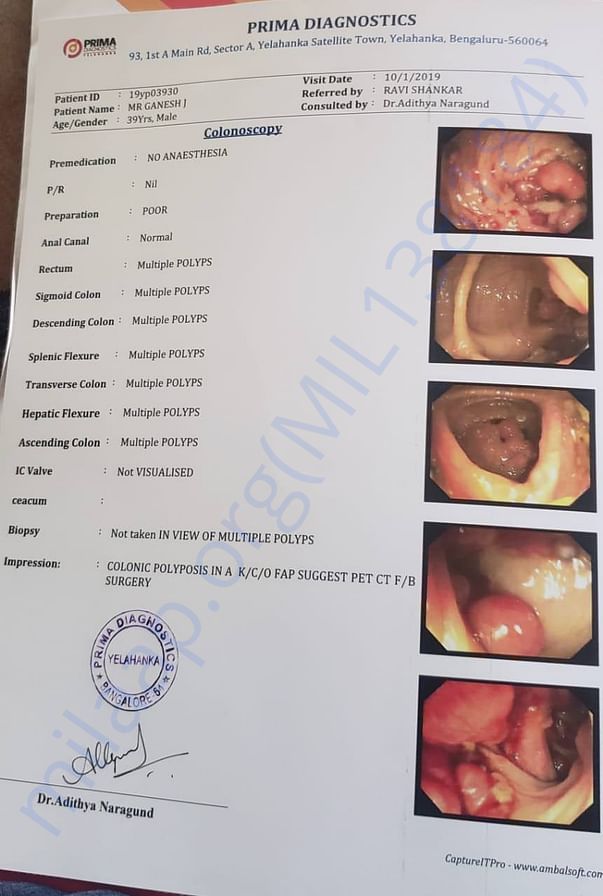 Colonoscopy