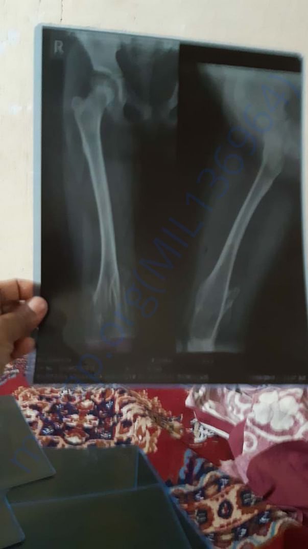 X-RAY