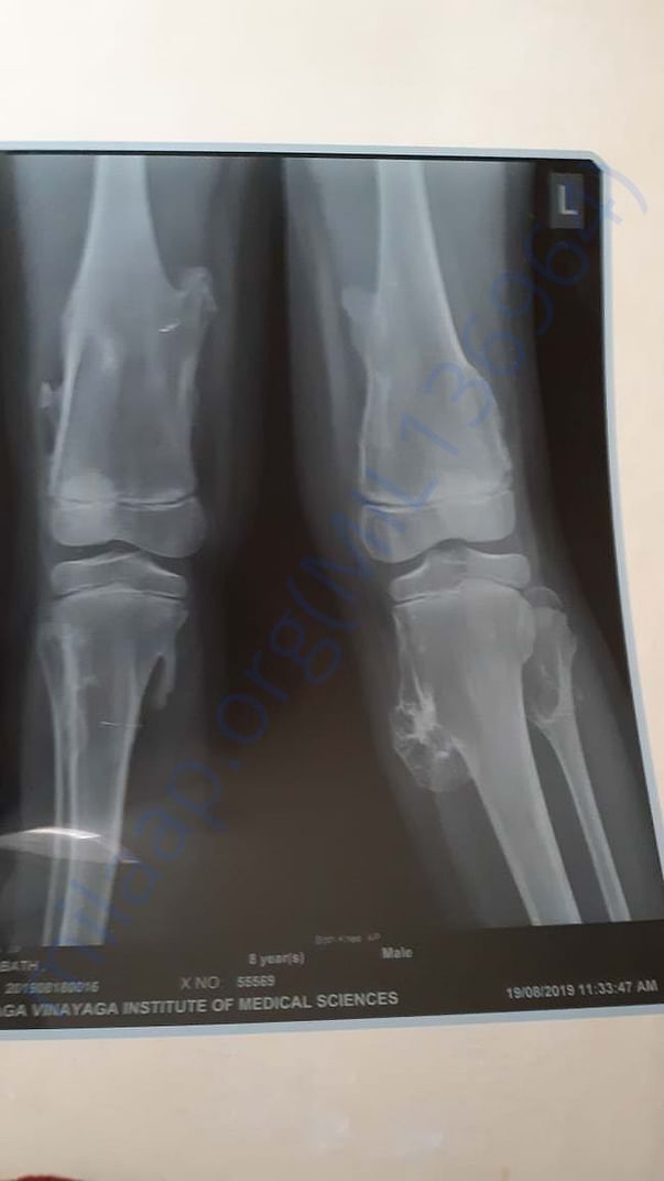X-RAY