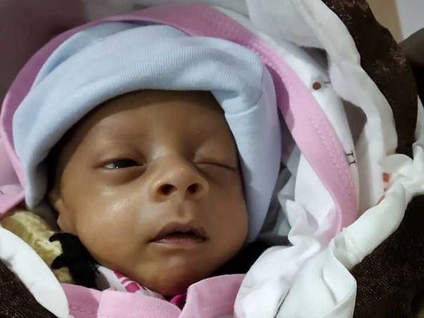 Help My Son Fight Low Birth Weight With IUGR Respiratory Distress Syndrome