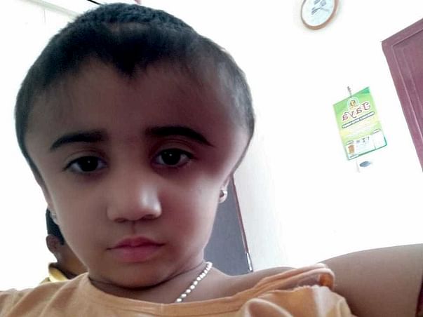 4 Years Old Varisha Needs Your Help To Recover From An Accident