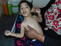 Help 4 yr old Anmol to survive and live a normal life