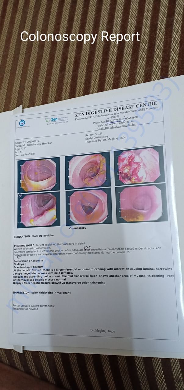 Colonoscopy Report
