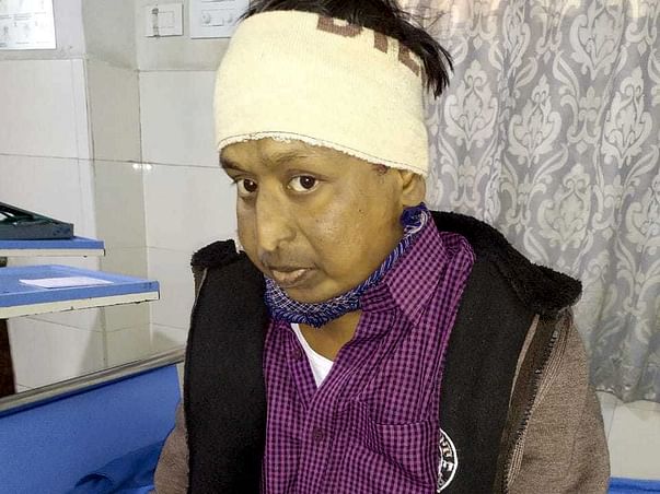 Support Afroz Recover From Chronic Kidney Disease