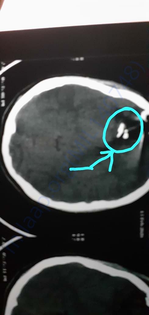 Xray