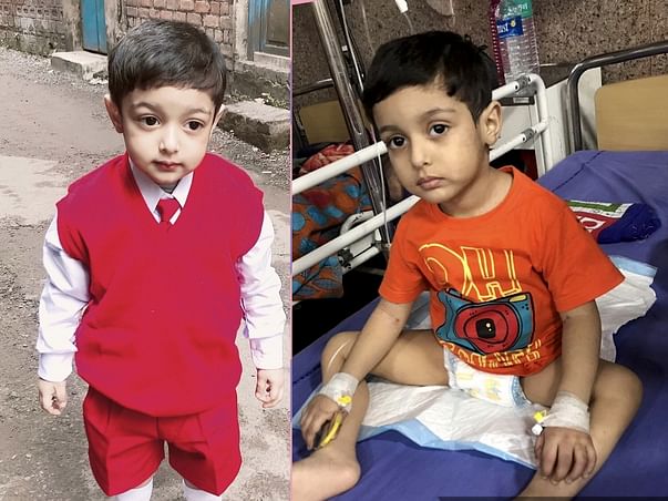 Help Ishaan Fight Acute Lymphoblastic Leukemia (all)