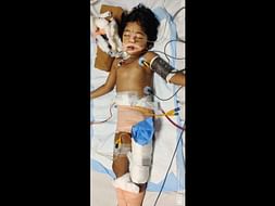 Help My Daughter Recover From An Accident