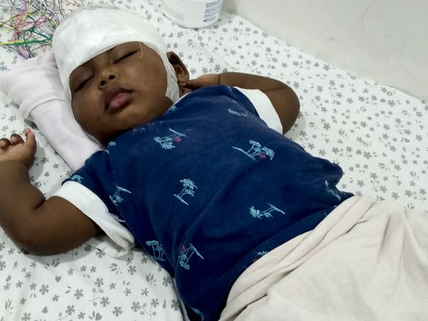 Help Thaara for brain surgery