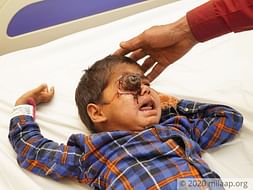 Help Komal fight Bilateral Retinoblastoma