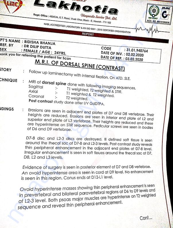 MRI REPORT