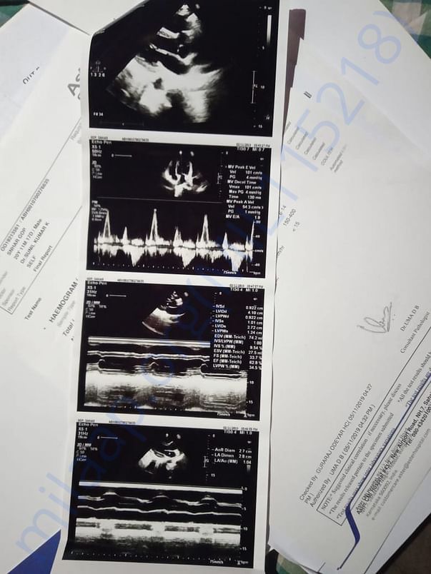 Ultrasound report