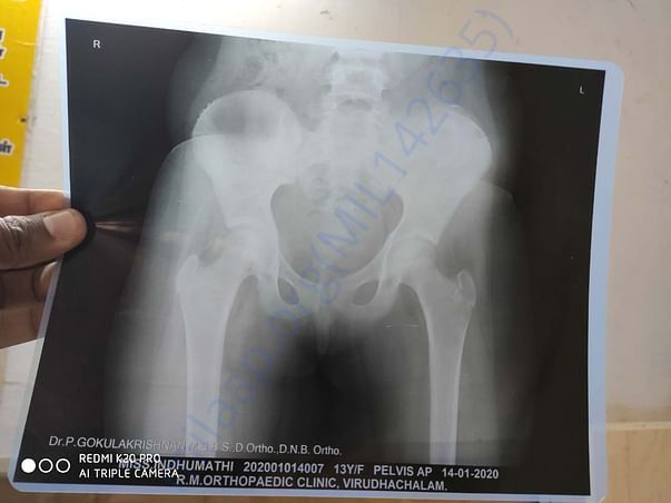 X ray