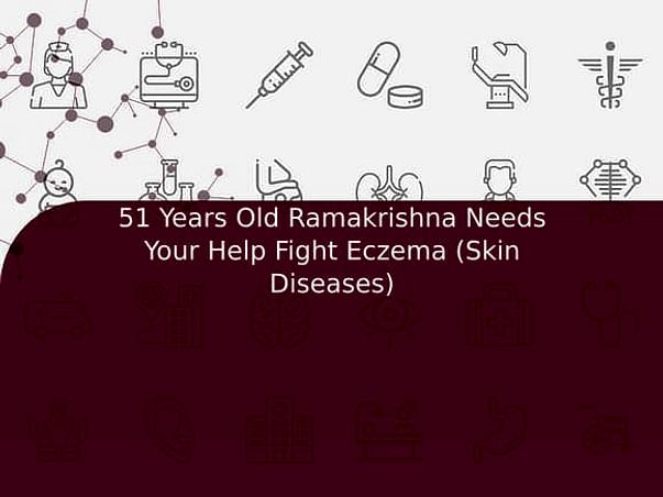 51 Years Old Ramakrishna Needs Your Help Fight Eczema (Skin Diseases)