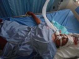 Support GowraBai Mother of 6 Children Recover From Head Injuries