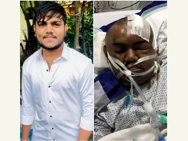 Help Himanshu Patel Fight Accident Injuries