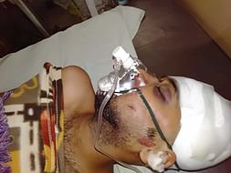21 Years Old Sagar Awatramani Needs Your Help Fight Road Traffic Accident (Multiple Injury)