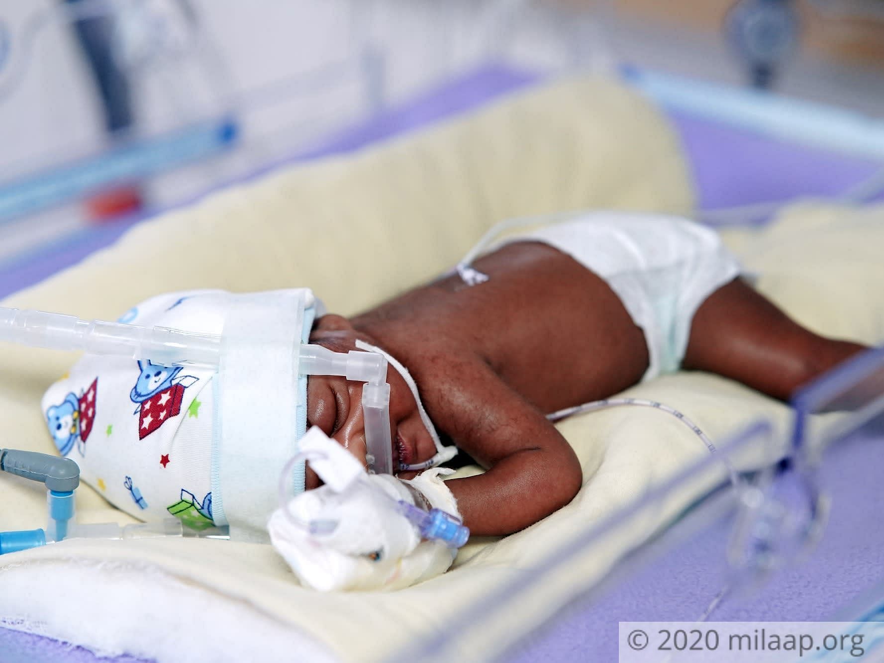 7th month premature baby