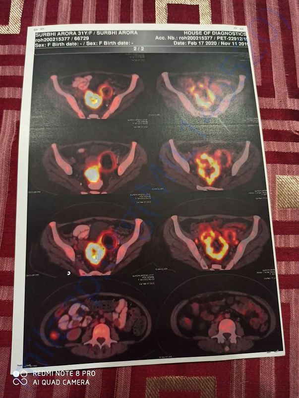 Petct report