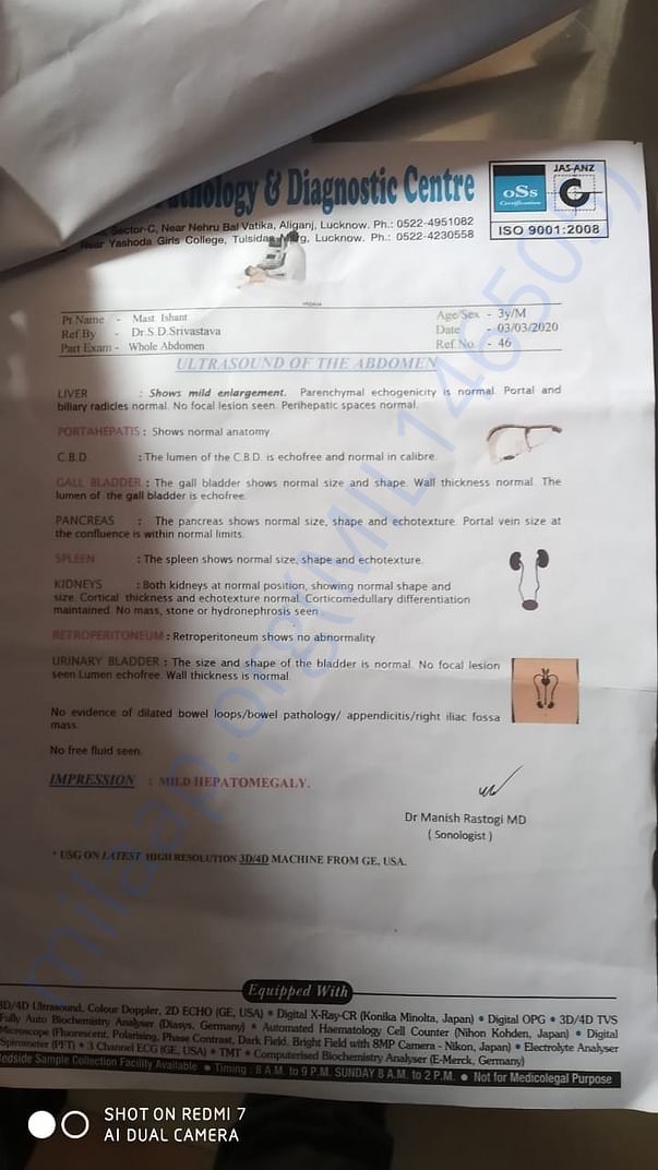 Liver report