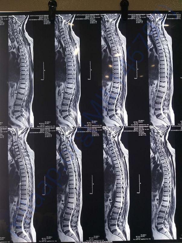 MRI film-1
