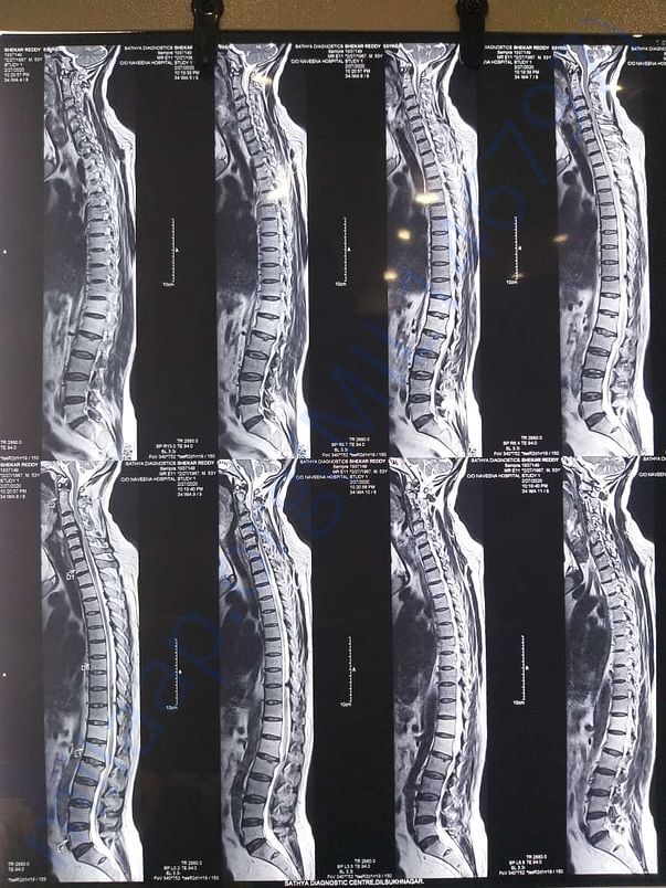 MRI film-2