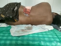 Help My Father Undergo Surgery
