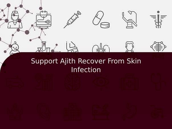 Support Ajith Recover From Skin Infection