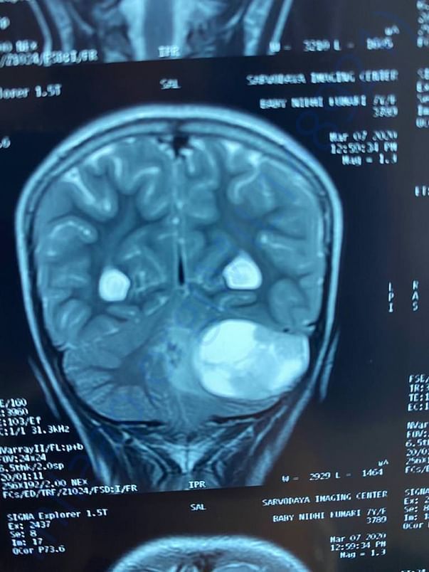 MRI1